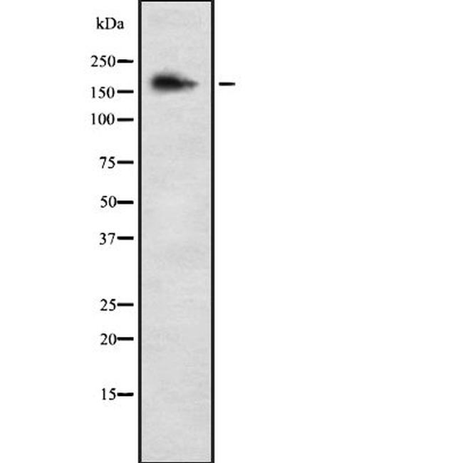 COL5A3 Antibody in Western Blot (WB)