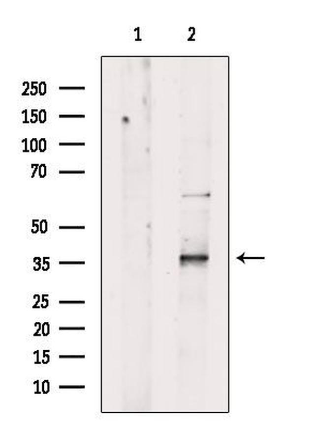 ZFP36L1 Antibody in Western Blot (WB)