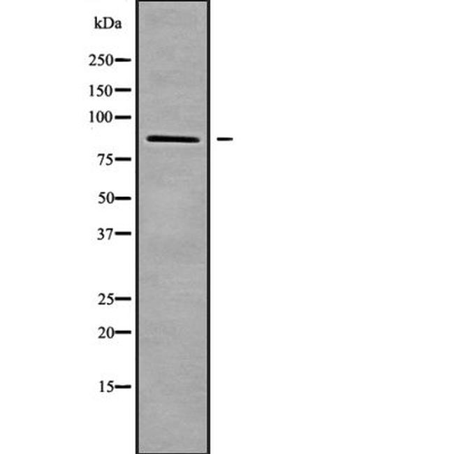 ZNF839 Antibody in Western Blot (WB)