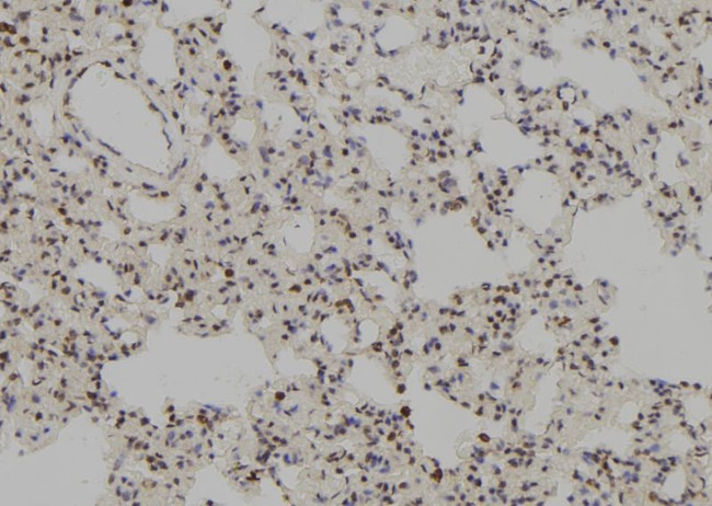 MSH3 Antibody in Immunohistochemistry (Paraffin) (IHC (P))