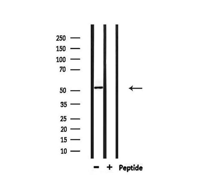 PFKFB1/PFKFB4 Antibody in Western Blot (WB)
