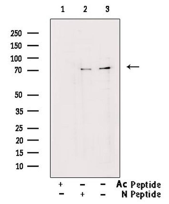 Acetyl-FOXO1 (Lys294) Antibody in Western Blot (WB)