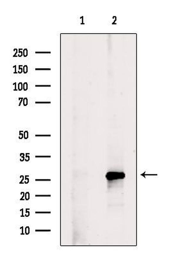 Phospho-Bim (Ser77) Antibody in Western Blot (WB)