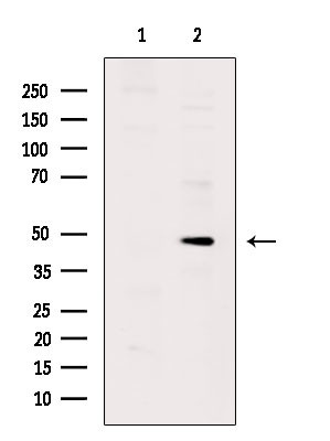 Phospho-Cytokeratin 17 (Ser44) Antibody in Western Blot (WB)