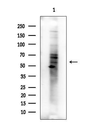 Phospho-Cytokeratin 20 (Ser13) Antibody in Western Blot (WB)