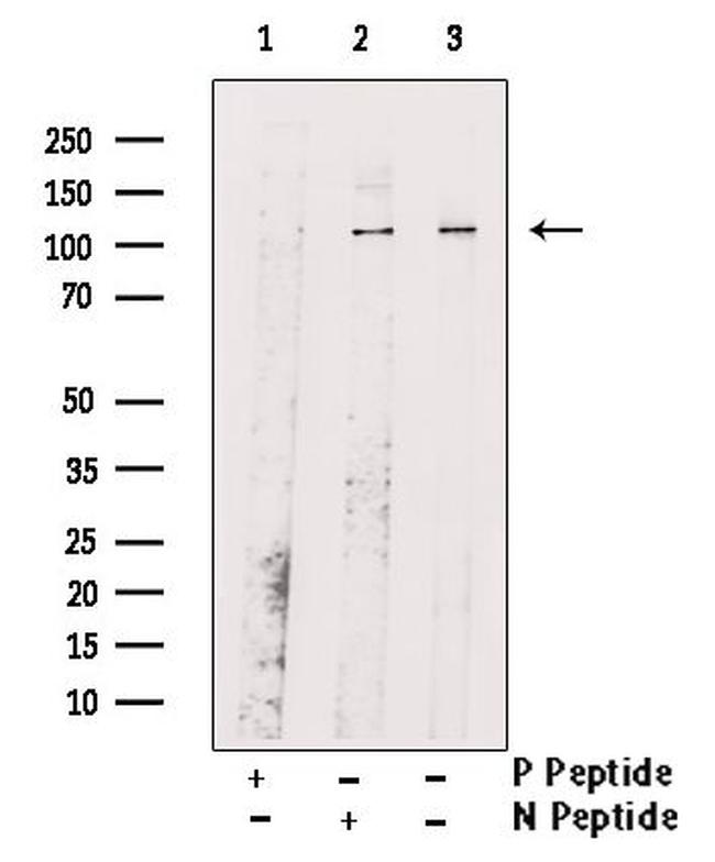 Phospho-Rb (Ser608) Antibody in Western Blot (WB)