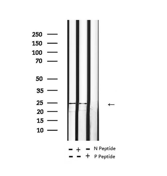 Phospho-TPT1 (Ser46) Antibody in Western Blot (WB)