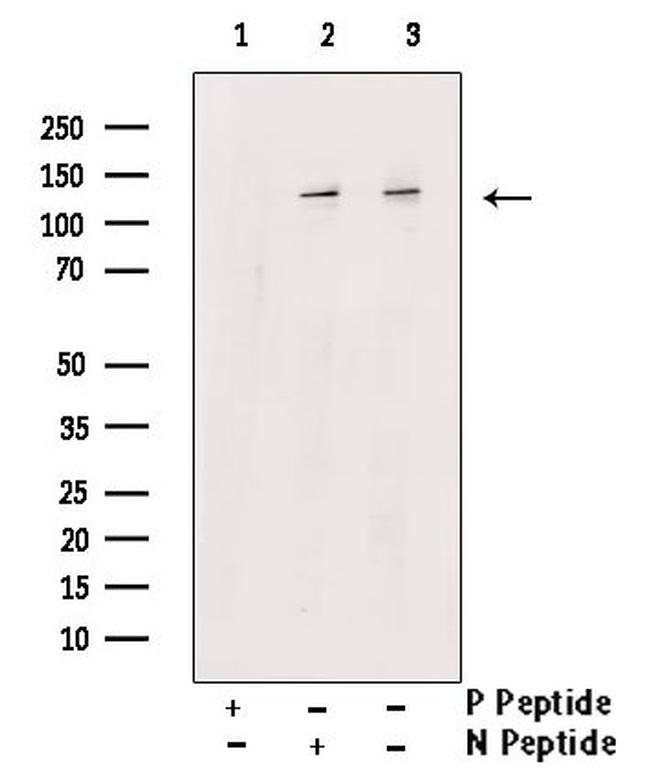 Phospho-TrkA (Tyr490) Antibody in Western Blot (WB)