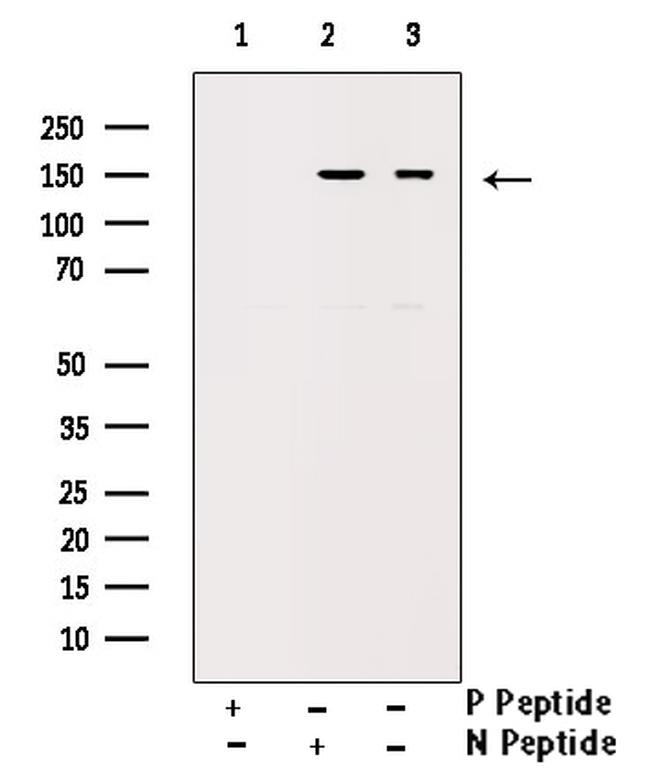 Phospho-ErbB2 (HER-2) (Tyr1112) Antibody in Western Blot (WB)