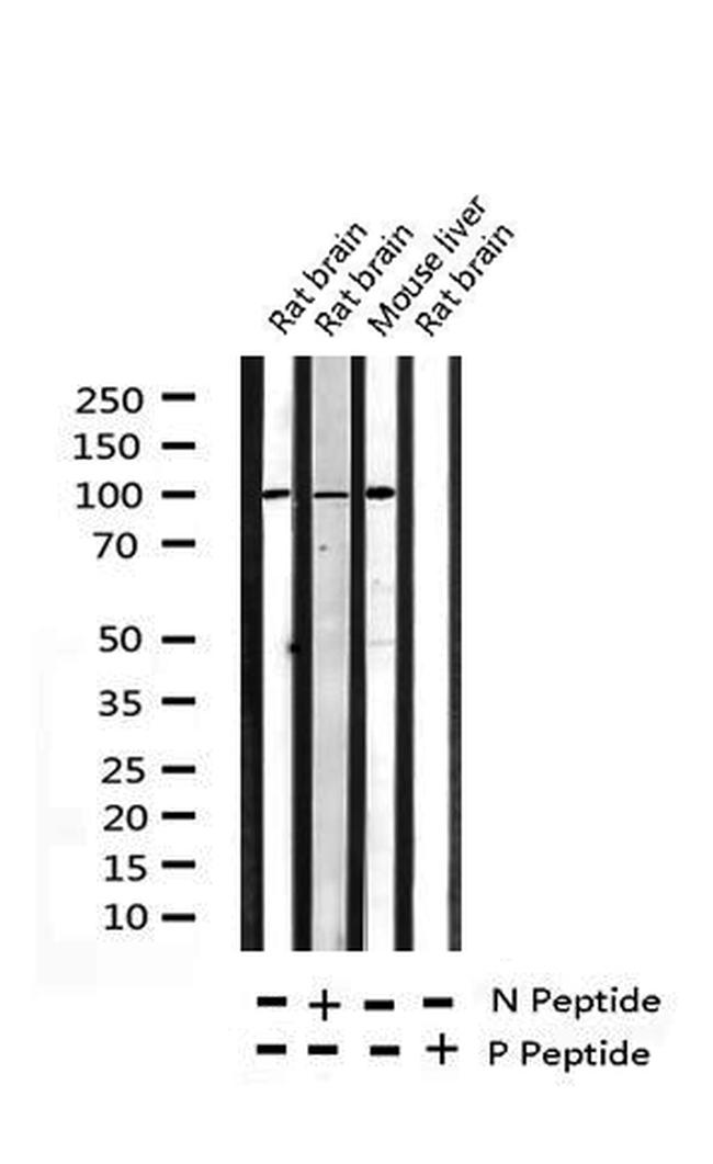 Phospho-ATP1A1 (Ser16) Antibody in Western Blot (WB)