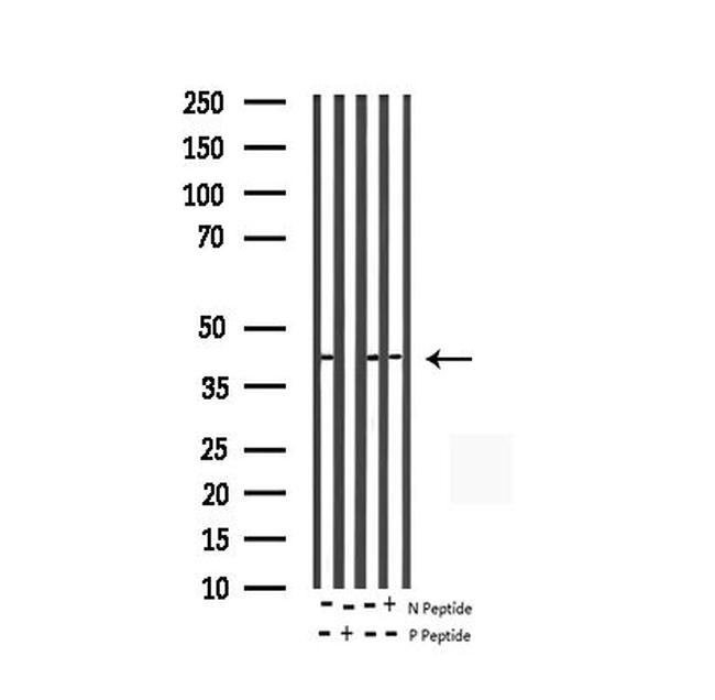 Phospho-c-Jun (Thr93) Antibody in Western Blot (WB)