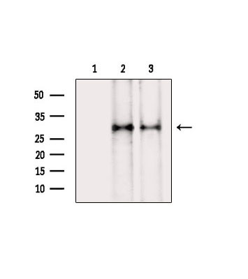 Phospho-AKT1 (Ser124) Antibody in Western Blot (WB)