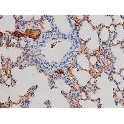 Phospho-AKT1 (Ser124) Antibody in Immunohistochemistry (Paraffin) (IHC (P))