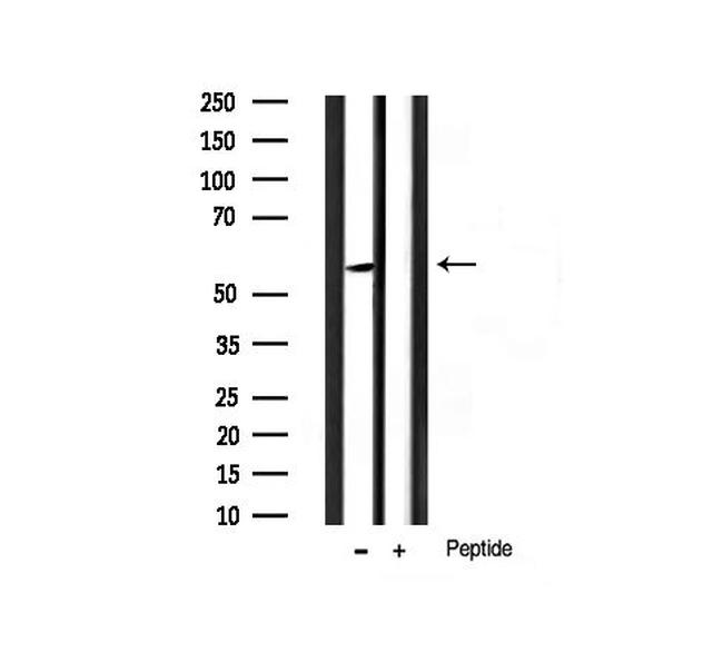 Phospho-AKT1/AKT2/AKT3 (Ser124) Antibody in Western Blot (WB)
