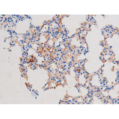 Phospho-IRS1 (Ser639) Antibody in Immunohistochemistry (Paraffin) (IHC (P))
