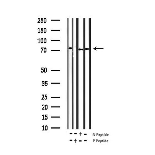 Phospho-ZAP-70 (Tyr493) Antibody in Western Blot (WB)