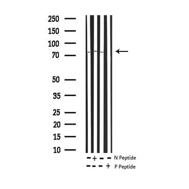 Phospho-SYK (Tyr348) Antibody in Western Blot (WB)