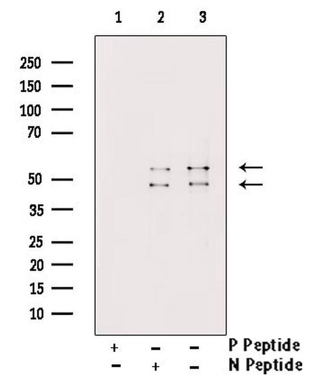 Phospho-JNK1/JNK2/JNK3 (Tyr185) Antibody in Western Blot (WB)
