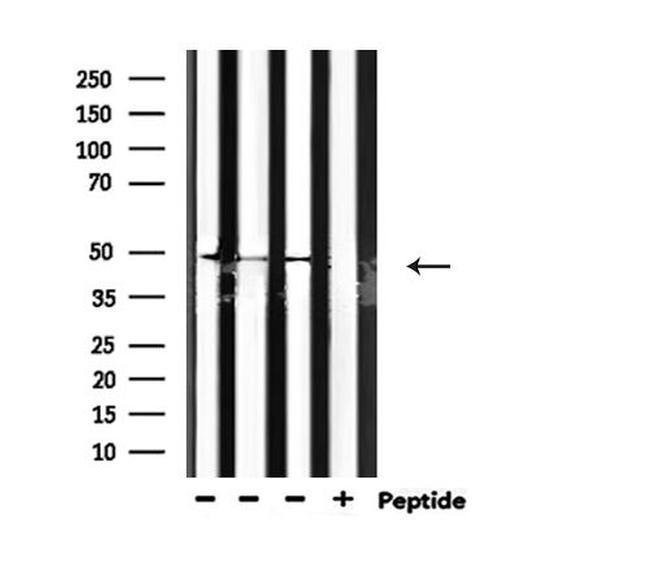 Phospho-GSK3 alpha/beta (Tyr279, Tyr216) Antibody in Western Blot (WB)