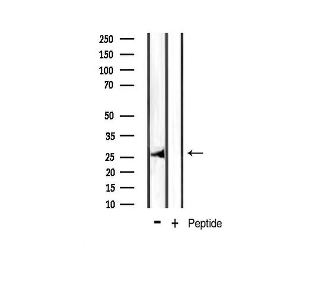 Phospho-Bcl-xL (Thr47) Antibody in Western Blot (WB)