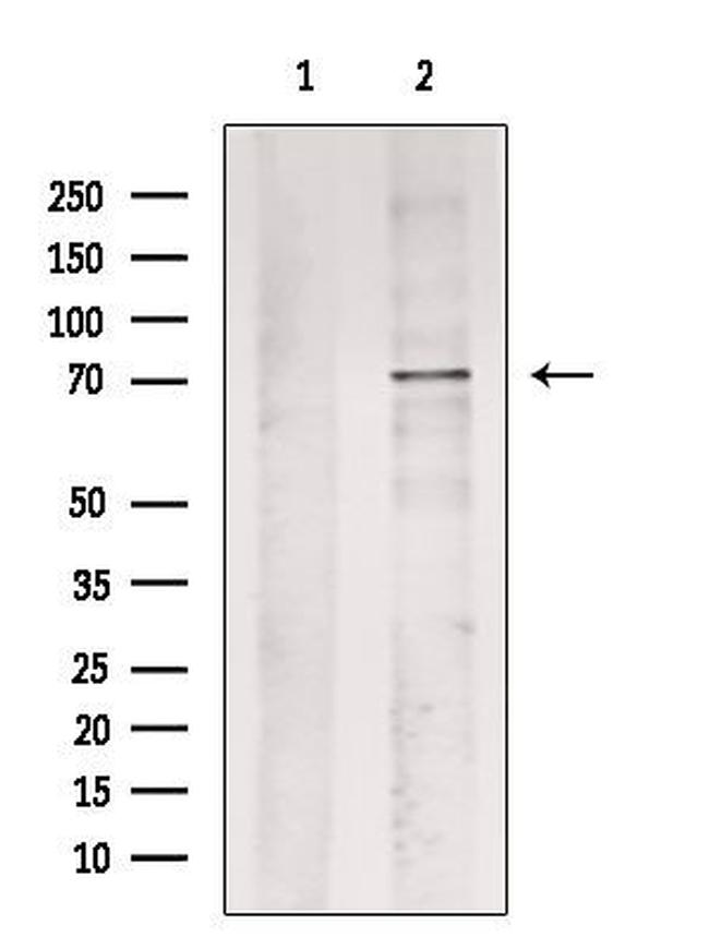 Phospho-AMPK alpha-1 (Ser485, Ser491) Antibody in Western Blot (WB)
