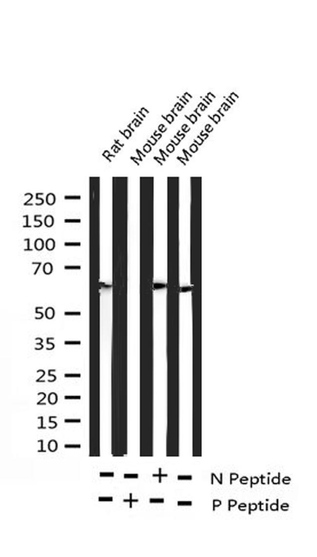 Phospho-DOK1 (Tyr398) Antibody in Western Blot (WB)