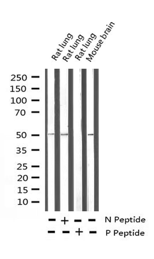 Phospho-CaMKII alpha/delta (Thr286) Antibody in Western Blot (WB)
