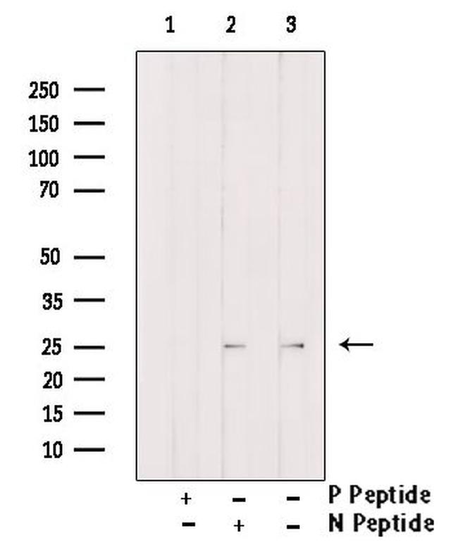Phospho-Claudin 5 (Thr207 ) Antibody in Western Blot (WB)
