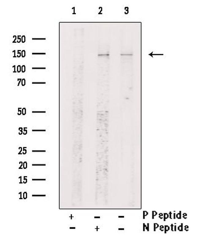 Phospho-SIN3A (Ser832) Antibody in Western Blot (WB)