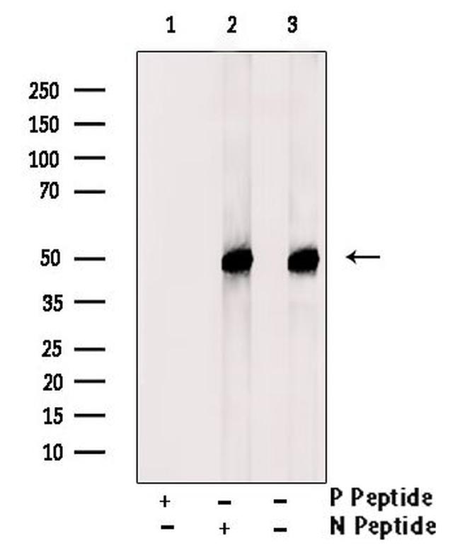 Phospho-DEPDC6 (Ser244) Antibody in Western Blot (WB)