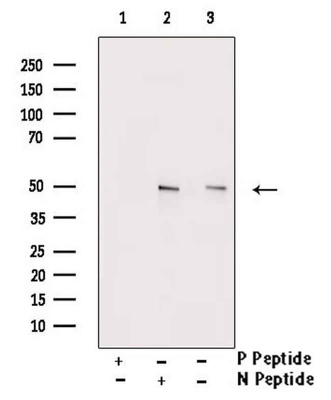 Phospho-PABPN1 (Ser150) Antibody in Western Blot (WB)