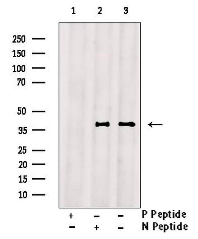Phospho-CD32 (Tyr288) Antibody in Western Blot (WB)