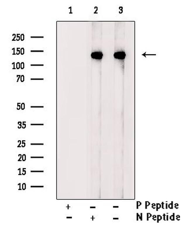 Phospho-ATP Citrate Lyase (Ser455, Ser457) Antibody in Western Blot (WB)