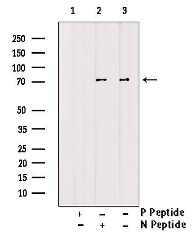 Phospho-ALOX5 (Ser272) Antibody in Western Blot (WB)