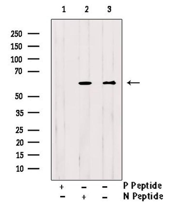 Phospho-HNF1A (Ser247) Antibody in Western Blot (WB)