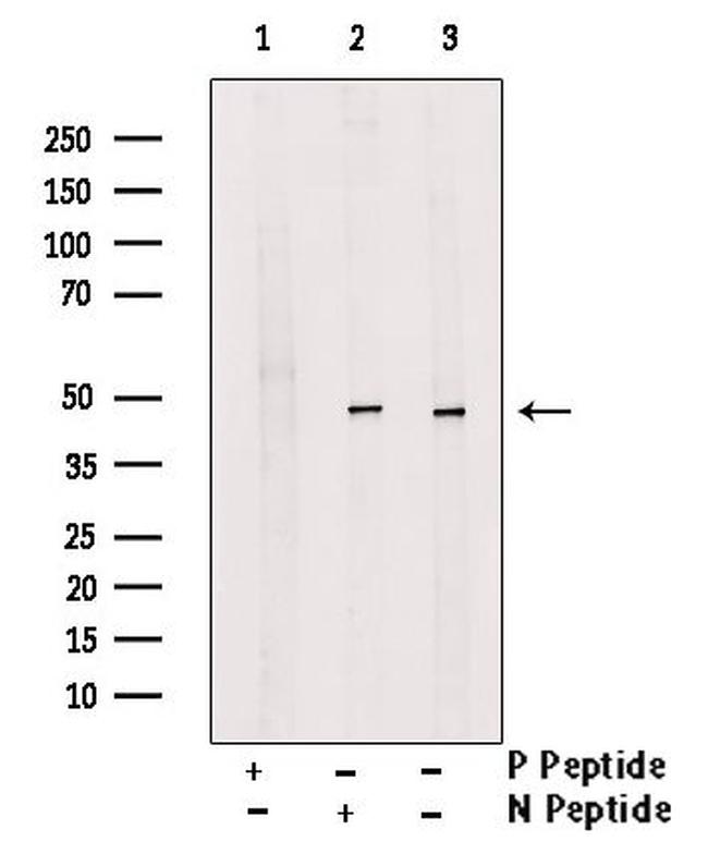 Phospho-Nkx2.1 (Ser23) Antibody in Western Blot (WB)