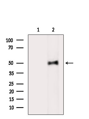 Phospho-FKBP4 (Tyr220) Antibody in Western Blot (WB)