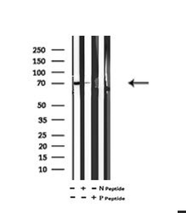 Phospho-FMRP (Ser500) Antibody in Western Blot (WB)