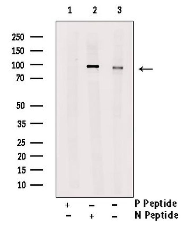 Phospho-LPIN1 (Thr14) Antibody in Western Blot (WB)