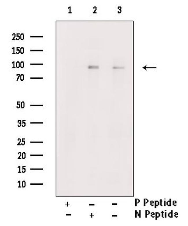 Phospho-MUSK (Tyr751) Antibody in Western Blot (WB)