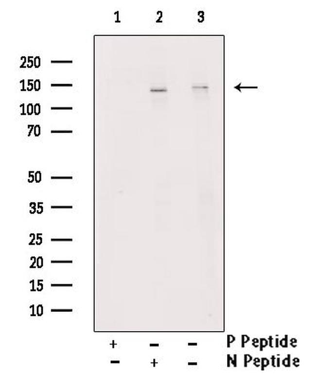 Phospho-SHIP2 (Tyr671) Antibody in Western Blot (WB)