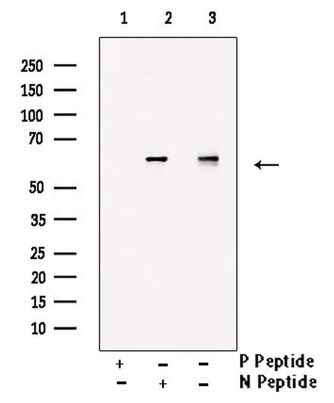 Phospho-PFKFB2 (Ser32) Antibody in Western Blot (WB)