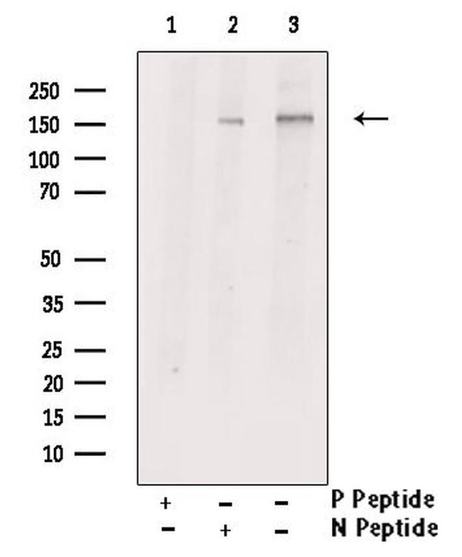 Phospho-ROCK2 (Ser1379) Antibody in Western Blot (WB)
