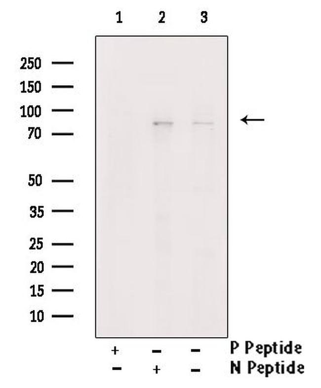 Phospho-PKC beta-1 (Thr642, Thr644) Antibody in Western Blot (WB)