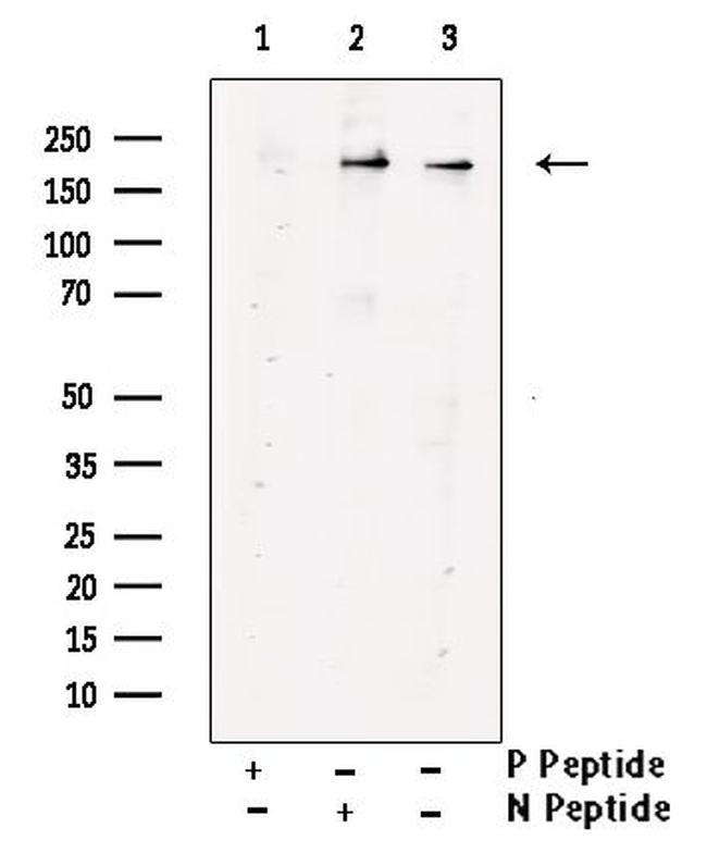 Phospho-VEGF Receptor 1 (Tyr1048) Antibody in Western Blot (WB)