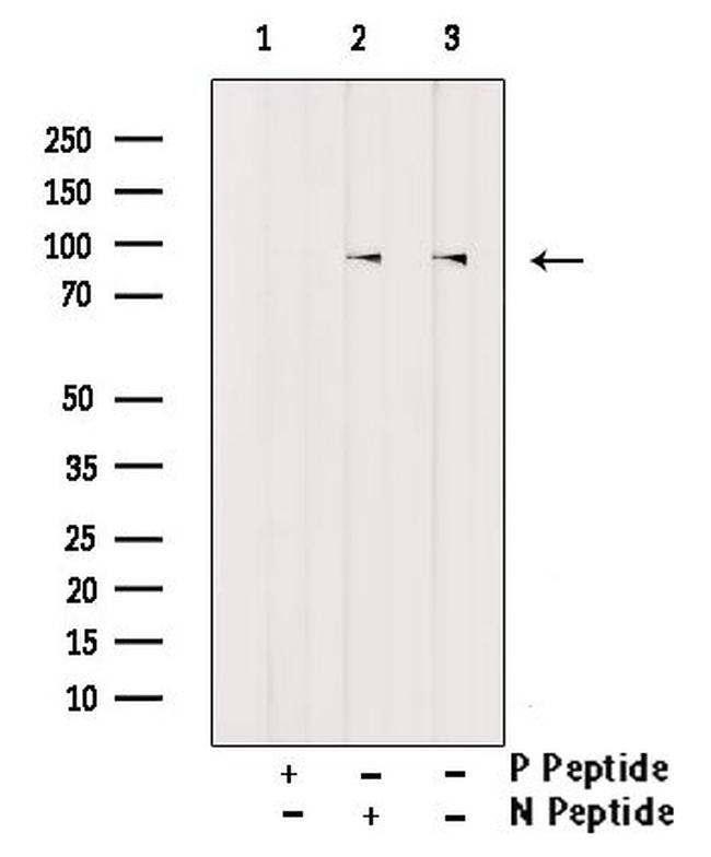 Phospho-FGFR4 (Tyr642) Antibody in Western Blot (WB)