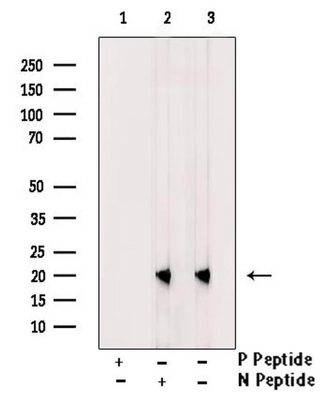 Phospho-Cofilin (Tyr140) Antibody in Western Blot (WB)