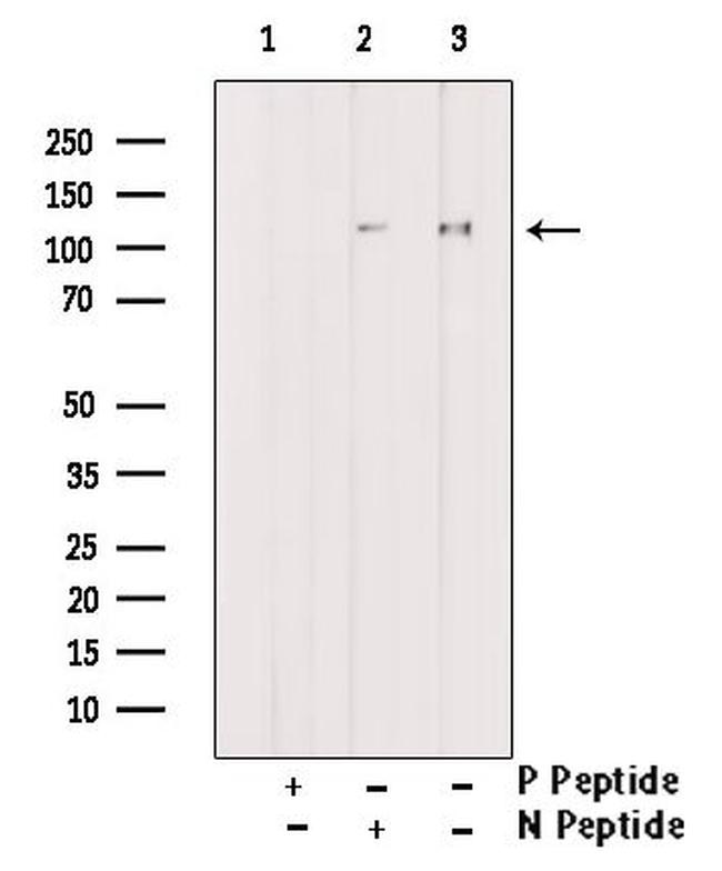 Phospho-ATP Citrate Lyase (Ser447) Antibody in Western Blot (WB)