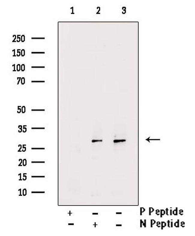 Phospho-Cdc42 (Tyr64) Antibody in Western Blot (WB)