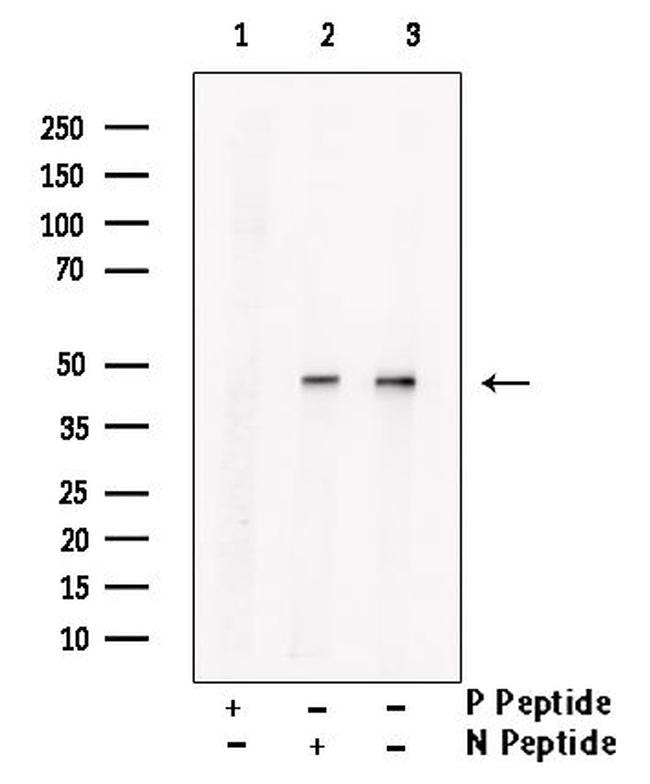 Phospho-Cytokeratin 17 (Tyr98) Antibody in Western Blot (WB)